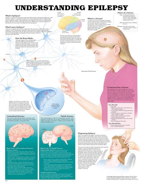 Understanding Epilepsy Poster Epilepsy Anatomical Chart Company