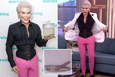 Human Ken Doll Rodrigo Alves Carries His Removed Ribs In A Jar As He