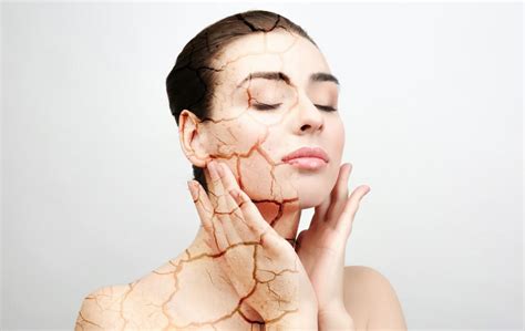 What Can I Do About Dry Skin Daphne Panagotacos Md Inc Dermatology