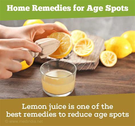 Top 10 Home Remedies To Get Rid Of Age Spots