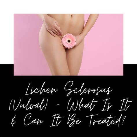 Lichen Sclerosus Vulval What Is It And Can It Be Treated