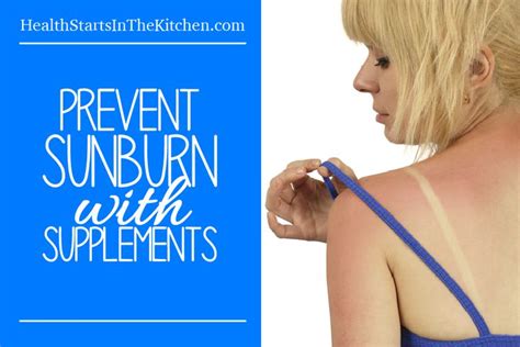 Prevent Sunburn With 6 Supplements Sunburn Prevention Health Info