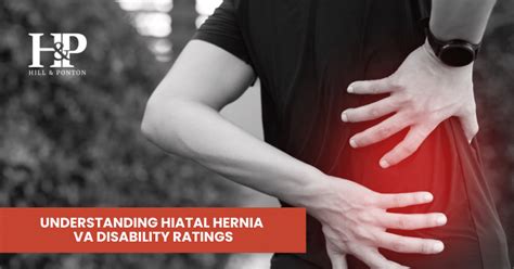 Hiatal Hernia Va Disability Rating Explained