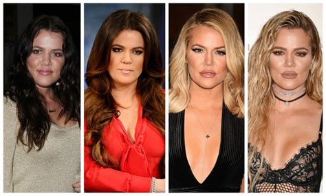Khloe Kardashian Plastic Surgery Before And After Photos