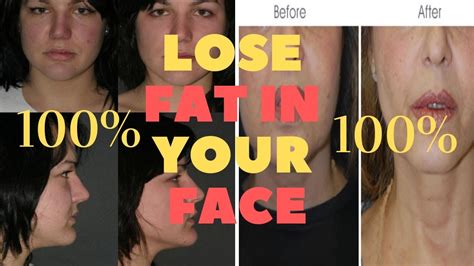 How To Lose Face Fat Fast In A Week With 7 Effective Tips Youtube