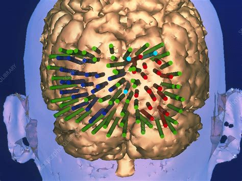 Functional specialization suggests that different areas in the brain are specialized for different functions. Functional map of the brain's visual cortex areas - Stock ...