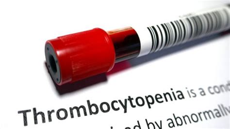 Blood Clots Platelets And Adenoviruses