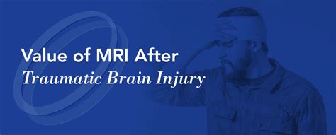 Value Of Mri After Traumatic Brain Injury Health Images