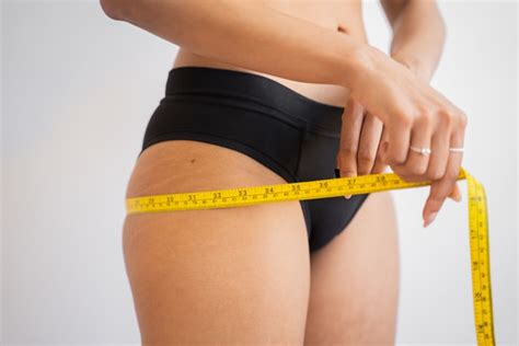 10 Things To Know About Stretch Marks On Inner Thighs
