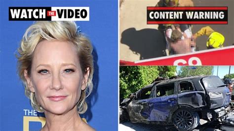 Anne Heche Ellen Degeneres Ex Girlfriend Severely Burned After La Crash Herald Sun