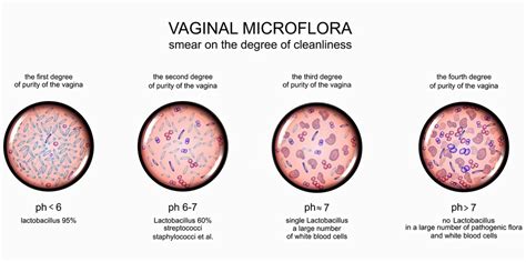 Abnormal White Blood Cell Count In A Vaginal Exam — Loungemodelseu
