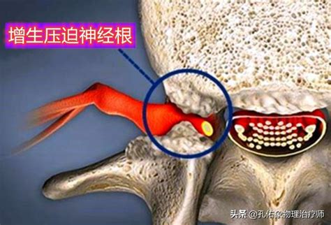 手麻、肩胛骨區域疼痛，是怎麼回事？不出意外，這3種可能性最大 每日頭條