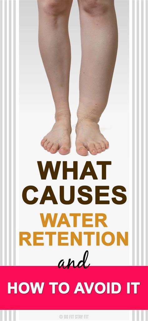 What Causes Water Retention And How To Avoid It Health Medicine