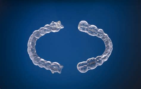 The only difference is that typical some people are told to wear their retainer the same amount of time as they were instructed to wear their invisalign trays—others, just at night. About Orthodontics | Khouri Orthodontics