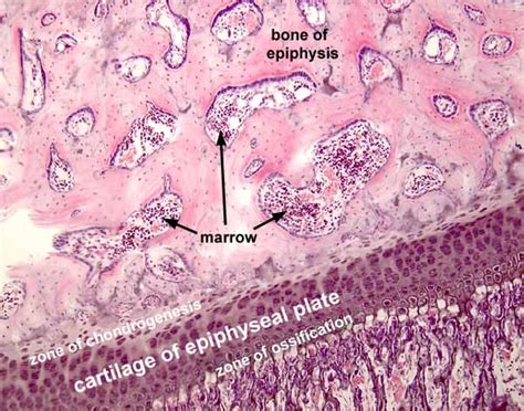 Endochondral Bone Formation Histology