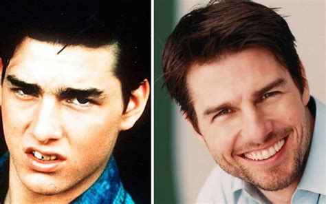 Tom Cruise Teeth The Truth About The Actor S Distinctive Misaligned Middle Tooth Revealed
