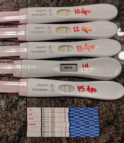 Progression From 10 Dpo To 15 Dpo Frer Tested With Fmu Pregmate Used