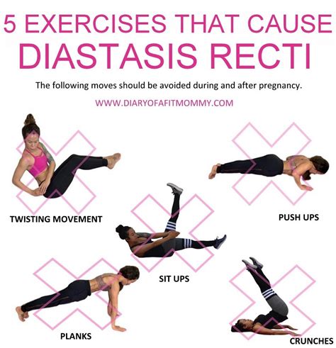 Can I Exercise With Diastasis Recti Online Degrees