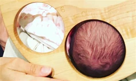 10 Cm Dilated Cervix Shocking Picture Shows How Big 10 Cm Dilation