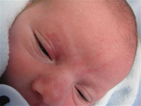 Babies normally exhibit mottled skin because of their immature circulatory system. PetitCherie Babies: August 2010