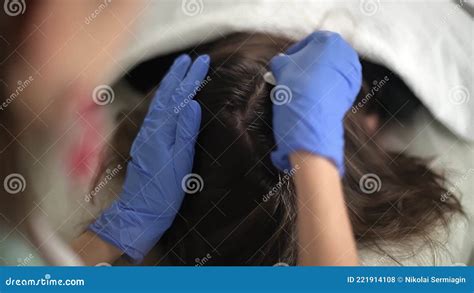 The Doctor Puts Injections Into The Scalp A Procedure For
