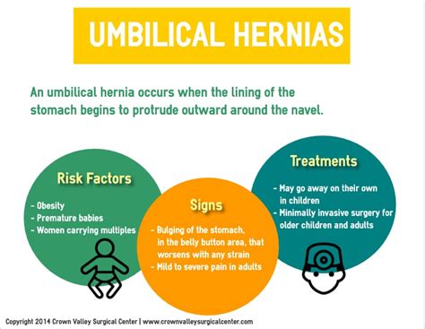 Umbilical Hernias Risks Signs And Treatment Cvsc
