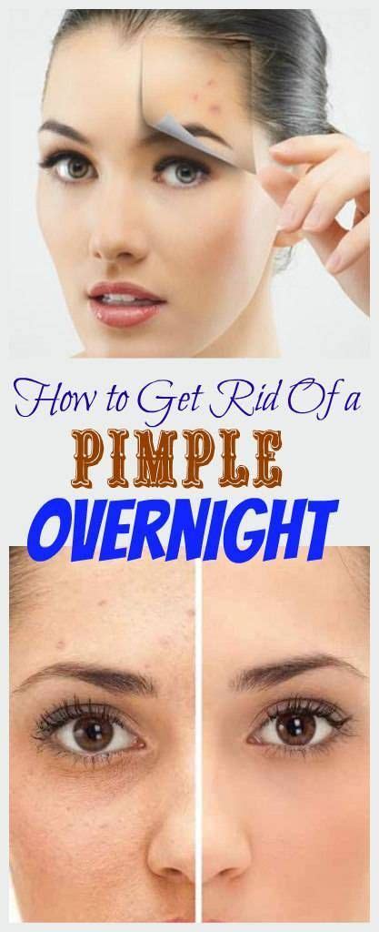 the best way to get rid of a pimple fast pimples overnight pimples pimples on forehead