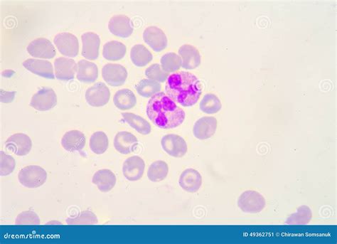 Segmented Neutrophils Stock Image Image Of Biology Band 49362751