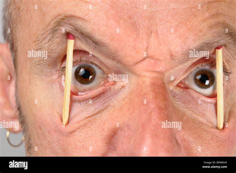 Close Up Of Ugly Man Keeping Eyes Wide Open With Match Sticks Stock