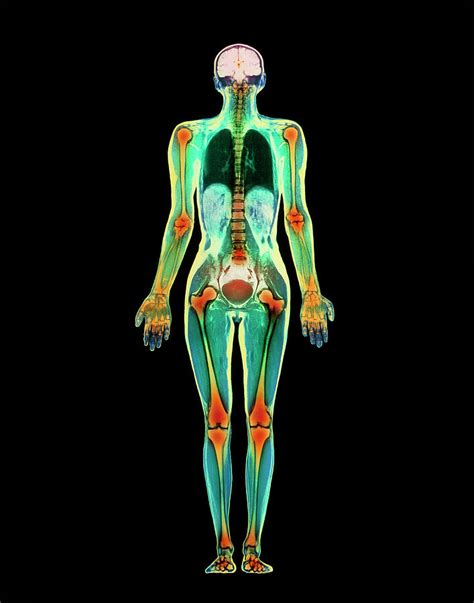 Cartoon woman body organs concept vector. Coloured Mri Scan Of A Whole Human Body (female ...