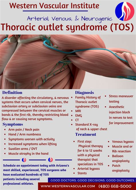 Thoracic Outlet Syndrome Treatment In Phoenix Arizona