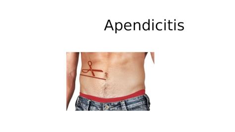 Pptx Apendicitis Cuidados De Enfermer A Pdfslide Net