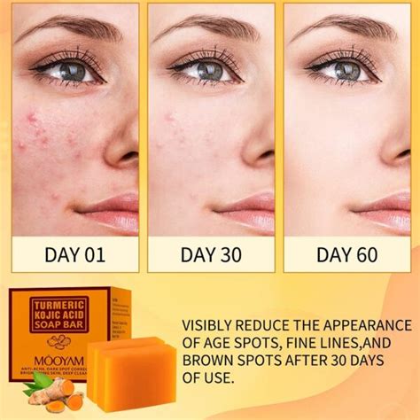 Kojic Acid Soap Before And After Does It Really Lighten Skin Must