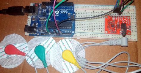 Ad8232 Ecg Sensor And Arduino Interfacing With Ecg Graph