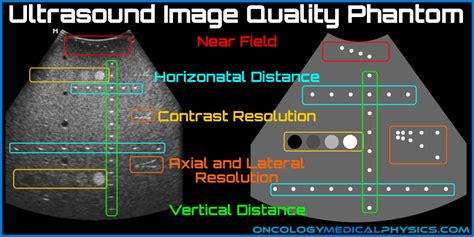 Ultrasound Image Quality Oncology Medical Physics