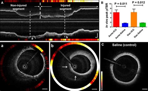 Fully Integrated High Speed Intravascular Optical Coherence Tomography