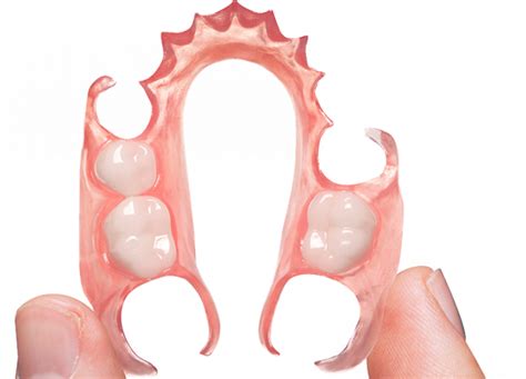 Flexible Partial Dentures Roe Dental Laboratory
