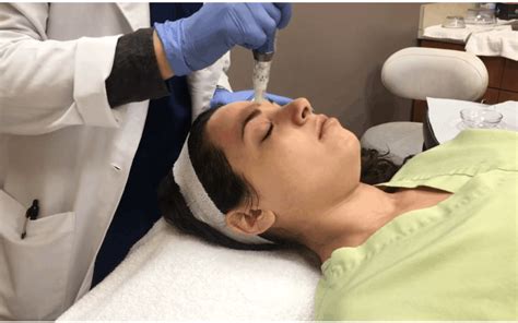 Microneedling Dermacare Hampton Roads Schedule A Consult