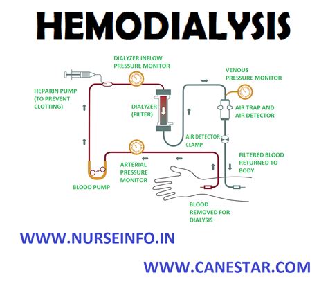 Hemodialysis Nurse Info