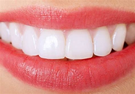 Which Dental Crown Type Is Best For You Ocean Breeze Prosthodontics