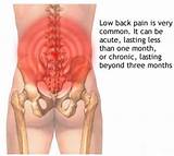 Pictures of Cause Of Pain In Lower Back Left Side