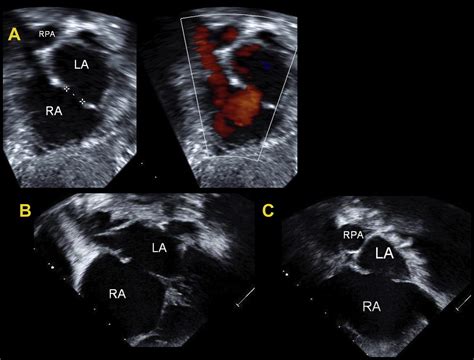 Supplemental Materials For Guidelines For The Echocardiographic