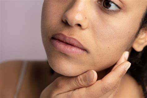 Pores Dilatés Causes Symptômes Et Traitement