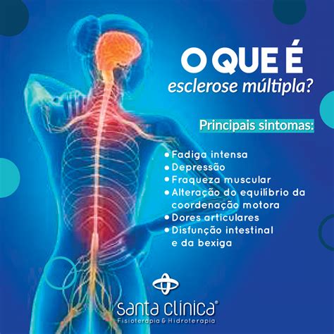 Multiple sclerosis (ms) is an autoimmune disease of the central nervous system (cns) characterized by chronic inflammation, demyelination, gliosis, and neuronal loss. Blog