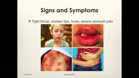 Allergy And Anaphylaxis Management Youtube
