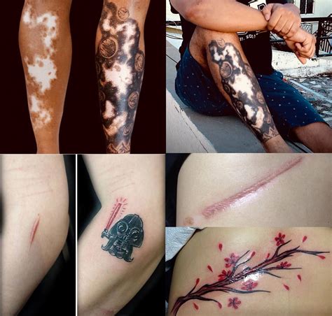 Top More Than Tattoos To Cover Scars On Legs In Eteachers