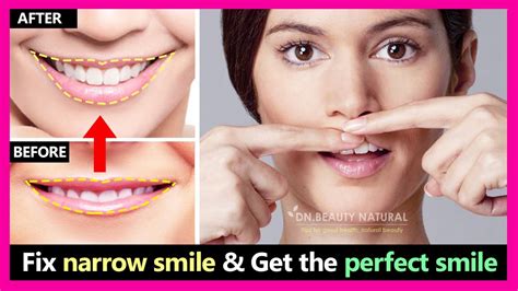 2 Steps How To Fix Narrow Smile And Make Smile Wider Get The