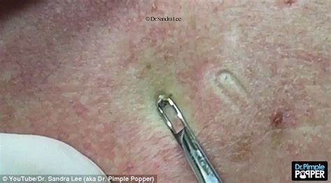 Pin On Skin Issues
