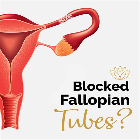 Ftr Symptoms And Causes Of Blocked Fallopian Tubes Fibroid