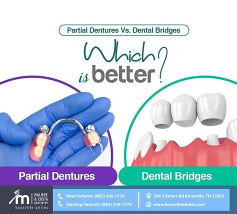 Partial Dentures Or Dental Bridges Are You Unsure Which One To Choose